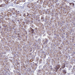 CBWD1 Antibody in Immunohistochemistry (Paraffin) (IHC (P))