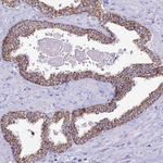 CBWD1 Antibody in Immunohistochemistry (Paraffin) (IHC (P))