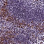CNEP1R1 Polyclonal Antibody