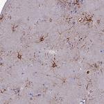 CYB561D2 Polyclonal Antibody