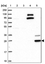 CYB561D2 Antibody in Western Blot (WB)