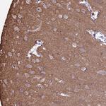 C3orf26 Antibody in Immunohistochemistry (Paraffin) (IHC (P))
