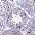 C3orf26 Antibody in Immunohistochemistry (Paraffin) (IHC (P))