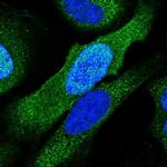 PSMC6 Polyclonal Antibody