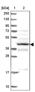 PSMC6 Antibody in Western Blot (WB)