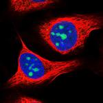 ZNF837 Polyclonal Antibody