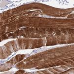 ZNF837 Antibody in Immunohistochemistry (Paraffin) (IHC (P))