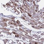 WDR83 Antibody in Immunohistochemistry (Paraffin) (IHC (P))