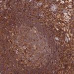 DENND1C Polyclonal Antibody