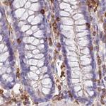 DENND1C Antibody in Immunohistochemistry (IHC)
