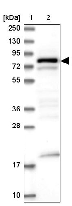 DENND1C Antibody in Western Blot (WB)