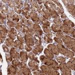 ARHGAP40 Antibody in Immunohistochemistry (Paraffin) (IHC (P))