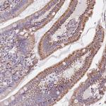 SYNGR3 Antibody in Immunohistochemistry (Paraffin) (IHC (P))