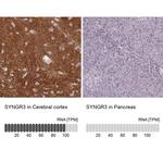 SYNGR3 Antibody in Immunohistochemistry (IHC)