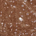SYNGR3 Antibody in Immunohistochemistry (IHC)