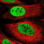 ARS2 Polyclonal Antibody