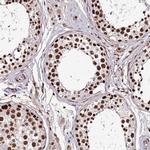 ARS2 Antibody in Immunohistochemistry (Paraffin) (IHC (P))