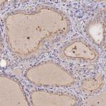 SLC26A4 Polyclonal Antibody