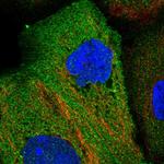 EPB41L4B Polyclonal Antibody