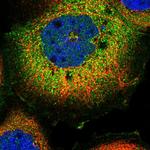 FAM126A Polyclonal Antibody