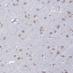 AROS Antibody in Immunohistochemistry (IHC)