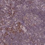AROS Antibody in Immunohistochemistry (IHC)