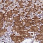AROS Antibody in Immunohistochemistry (IHC)