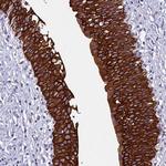 RBM41 Antibody in Immunohistochemistry (Paraffin) (IHC (P))