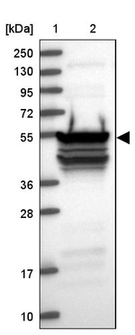 RBM41 Antibody in Western Blot (WB)