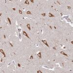 ABCA2 Antibody in Immunohistochemistry (Paraffin) (IHC (P))
