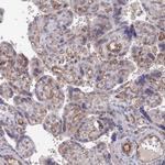 ARAP3 Antibody in Immunohistochemistry (Paraffin) (IHC (P))