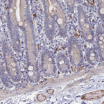 ARAP3 Antibody in Immunohistochemistry (Paraffin) (IHC (P))