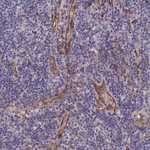 ARAP3 Antibody in Immunohistochemistry (Paraffin) (IHC (P))