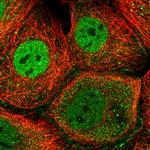 MIOS Polyclonal Antibody