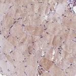 MIOS Antibody in Immunohistochemistry (Paraffin) (IHC (P))