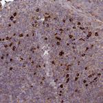 MIOS Antibody in Immunohistochemistry (Paraffin) (IHC (P))