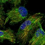 RABL5 Polyclonal Antibody