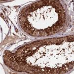 RABL5 Antibody in Immunohistochemistry (IHC)