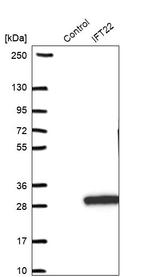 RABL5 Antibody in Western Blot (WB)