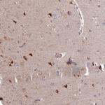 DTX2 Antibody in Immunohistochemistry (Paraffin) (IHC (P))