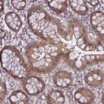 DTX2 Antibody in Immunohistochemistry (Paraffin) (IHC (P))