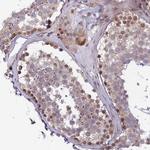 DTX2 Antibody in Immunohistochemistry (Paraffin) (IHC (P))