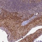 DTX2 Antibody in Immunohistochemistry (Paraffin) (IHC (P))