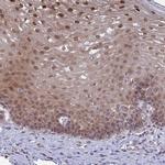 DTX2 Antibody in Immunohistochemistry (IHC)