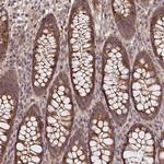 SMG6 Antibody in Immunohistochemistry (Paraffin) (IHC (P))