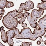 SMG6 Antibody in Immunohistochemistry (Paraffin) (IHC (P))