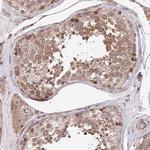 SMG6 Antibody in Immunohistochemistry (Paraffin) (IHC (P))