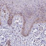 FRMPD1 Polyclonal Antibody