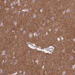 FRMPD1 Antibody in Immunohistochemistry (IHC)