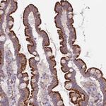 FRMPD1 Antibody in Immunohistochemistry (IHC)